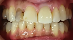 IMG_20240501_100943707_コピー_コピー_コピー