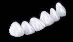 zirconia teeth