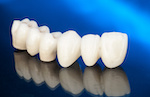 Ceramic Teeth_107283975