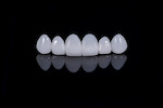 zirconia_581979078