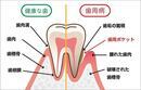歯周炎_コピー_コピー