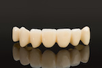 zirconia teeth_129213996