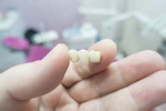 ceramic teeth_495263475