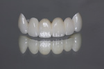 zirconia_432067641