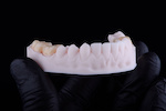 zirconia_1176076849