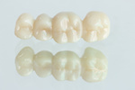 zirconia_323021722