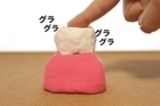 歯周病で歯がぐらぐら