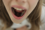 merits-of-ceramic-for-molars_603127617 (1)