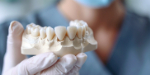 奥歯の治療に使用されるセラミックの種類と費用