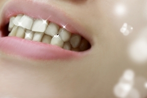 歯のクリーニング