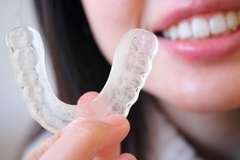 セラミックを守るためのナイトガード