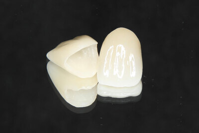 セラミッククラウン