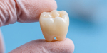 from-treatment-to-ceramic-teeth_1608988168