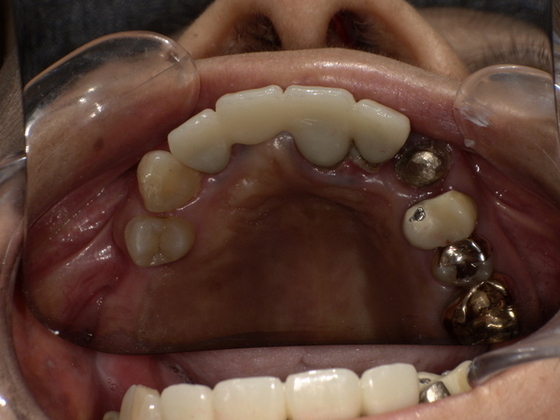 PICT0613_コピー_コピー