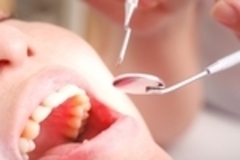 口腔内をチェック